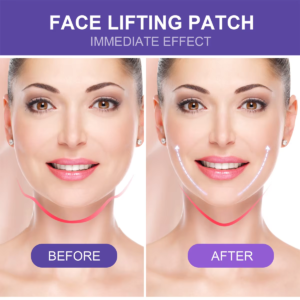 Cinta de Estiramiento facial Lifting
